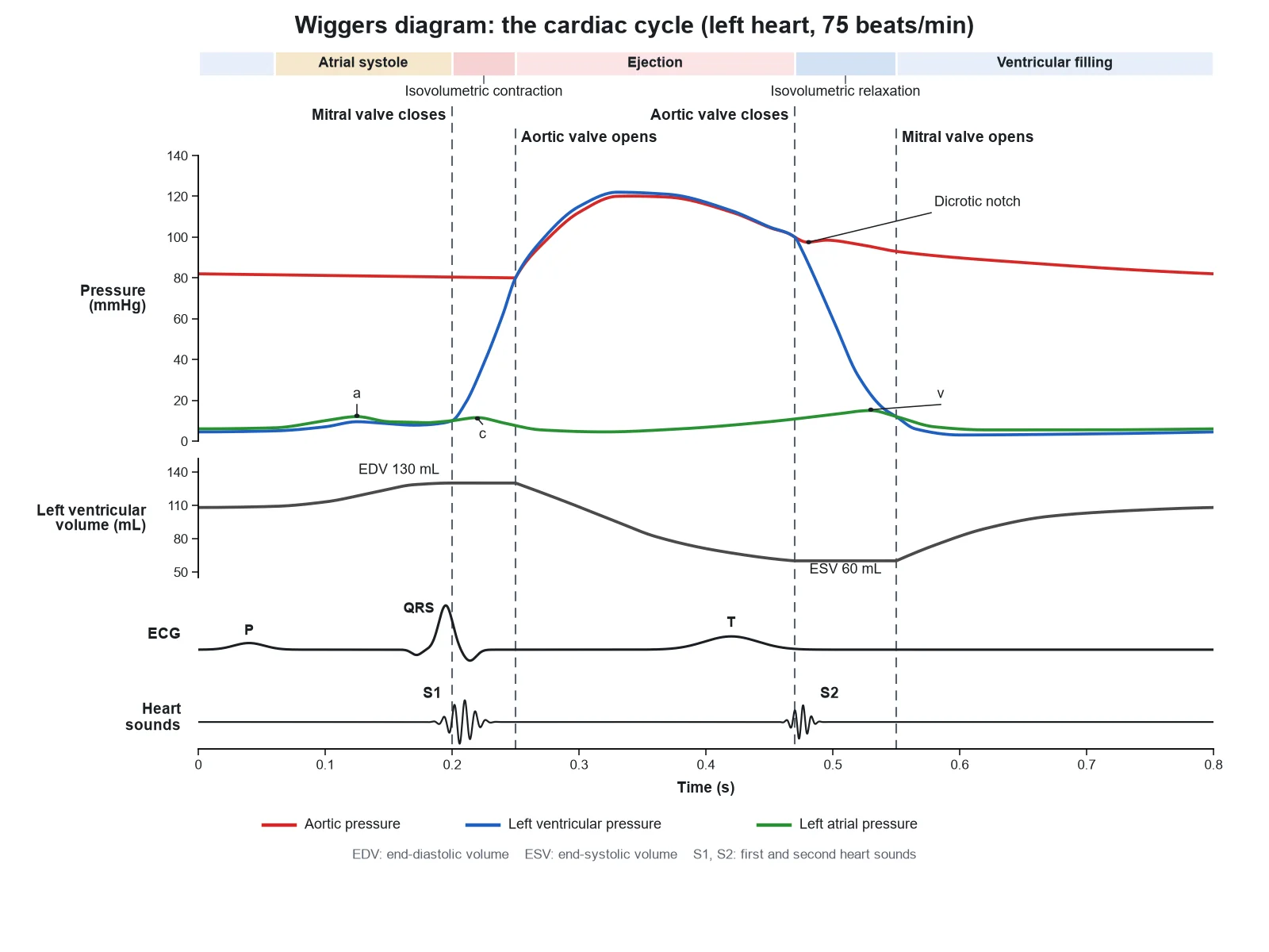 Wiggers Diagram Generator preview