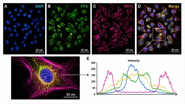 Per KI erstellte Fluoreszenzmikroskopie-Abbildung mit Kanälen, Merge-Panel, Maßstabsbalken und Intensitäts-Inset.